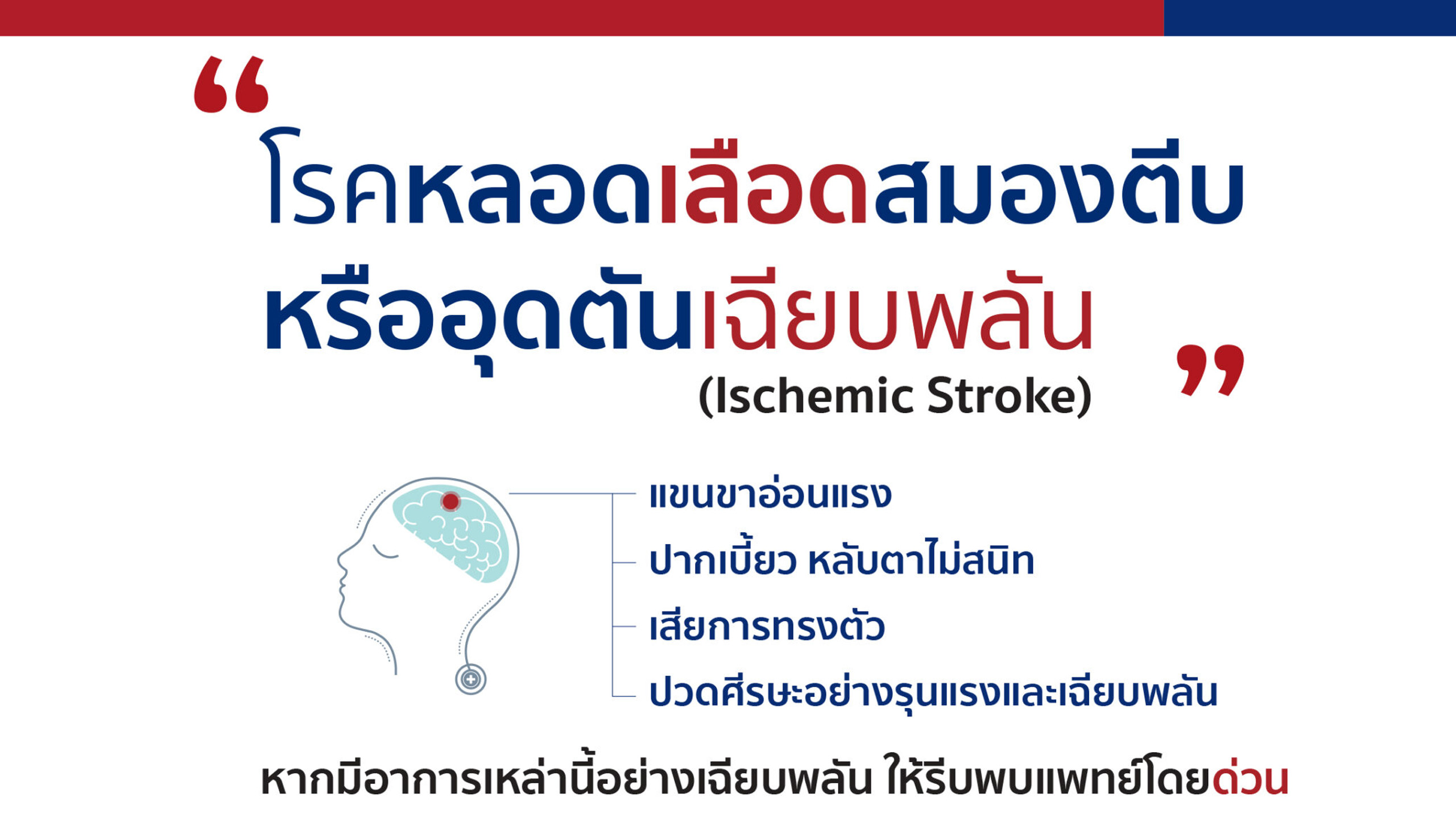 โรคหลอดเลือดสมองตีบหรืออุดตันเฉียบพลัน